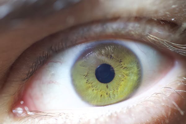 Prévenir et traiter les pathologies oculaires efficacement